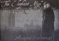 The Elephant Man. Anatomie d'un monstre