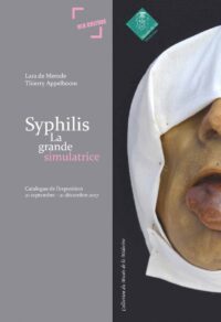 Syphilis, la grande simulatrice