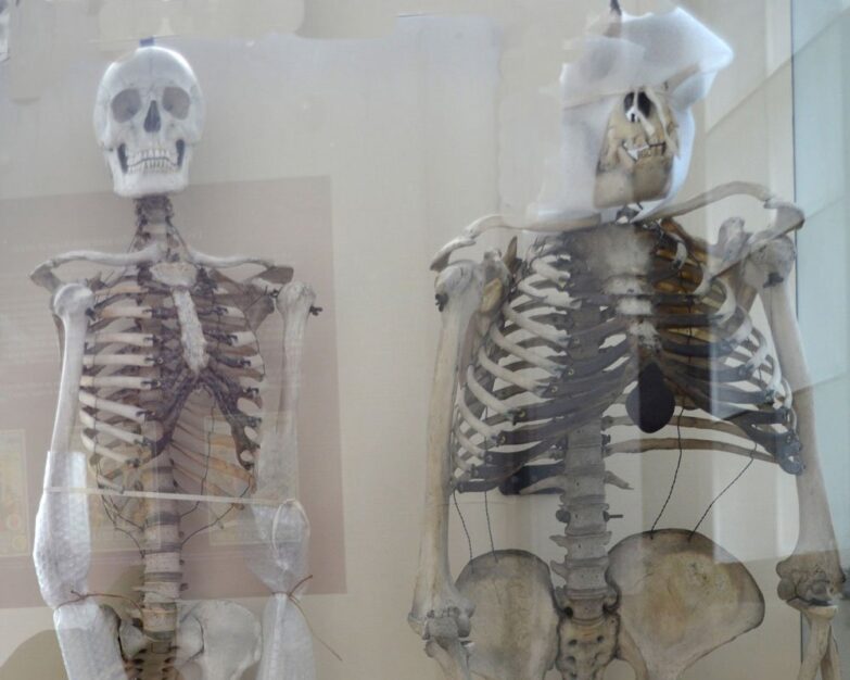 2-squelettes-redresses